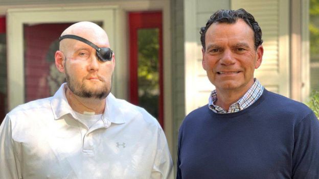 El veterano de EU que recibió el primer trasplante de ojo del mundo