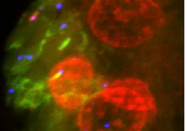 Las células del cáncer envejecen al sistema inmune para formar tumores