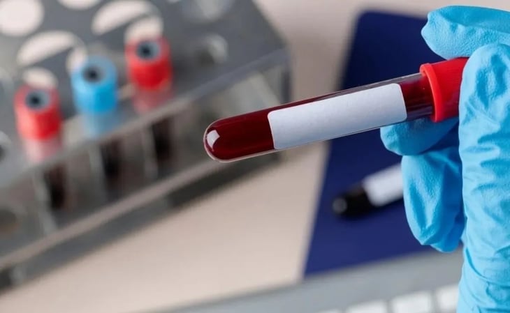 Crean una prueba sanguínea que ayuda a detectar el cáncer de ovario