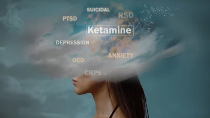 Ketamina: ¿No es mejor que el placebo para la depresión?