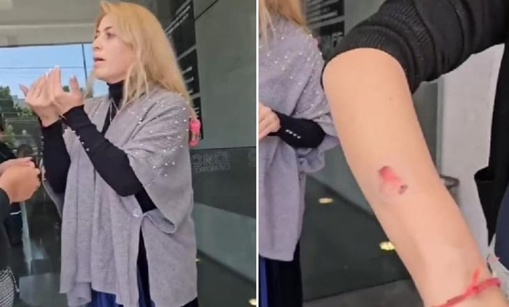 'Lady mordidas': Mujer ataca con mordiscos a manicurista para no pagarle arreglo de uñas en Edomex