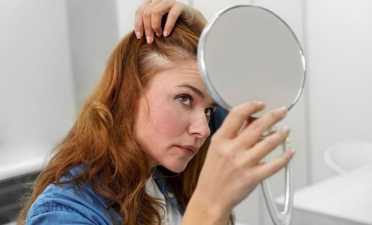 Cómo eliminar el acné que aparece en el cuero cabelludo