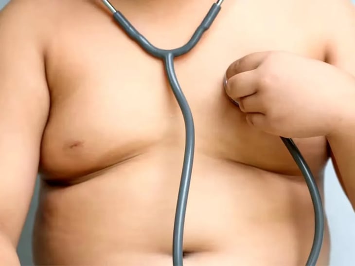 Epidemia de obesidad: proponen 15 medidas urgentes para frenar su avance y mejorar la salud