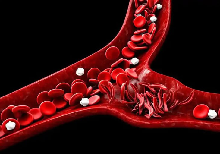 Europa recomienda la autorización del primer medicamento de edición genética para tratar una anemia mortal