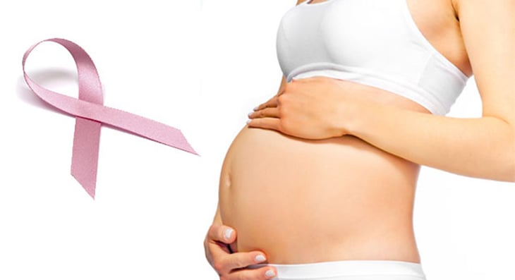 El embarazo es seguro después del cáncer de mama BRCA