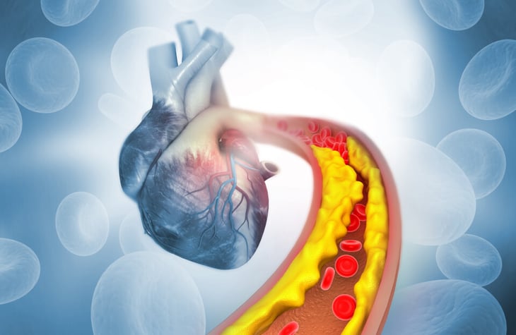 Vulnerabilidad al daño vascular de la hipertensión y el colesterol
