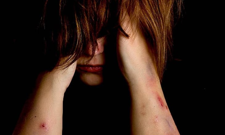 Reportan aumento en autolesiones como cortes, quemaduras y golpes entre jóvenes