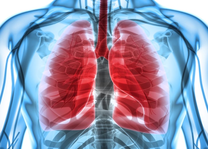 ¿Inhalar estatina podría ayudar a aliviar el asma y la EPOC?