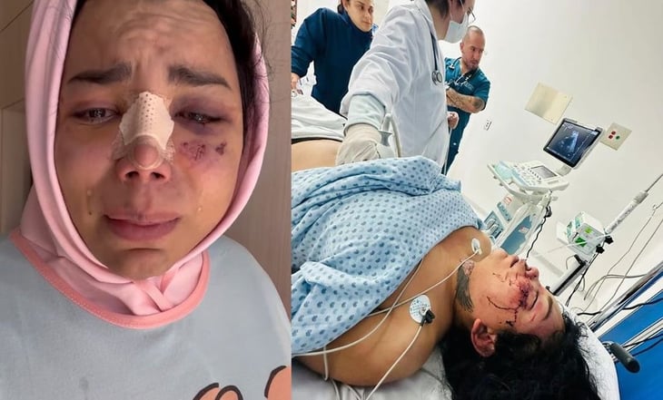 Dan de alta a Paolita Suarez del Hospital tras agresión de su pareja