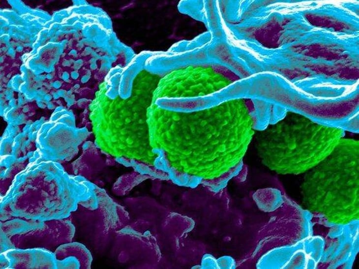 La crisis de las superbacterias amenaza con matar a 10 millones de personas al año para 2050