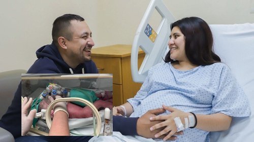 Nacen siamesas en hospital regio; requieren cirugía de hígado