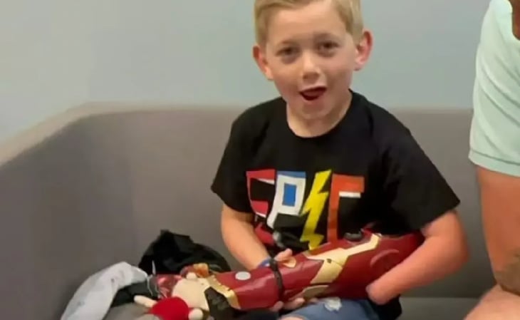 Niño recibe brazo biónico: siempre soñó con ser un superheroe