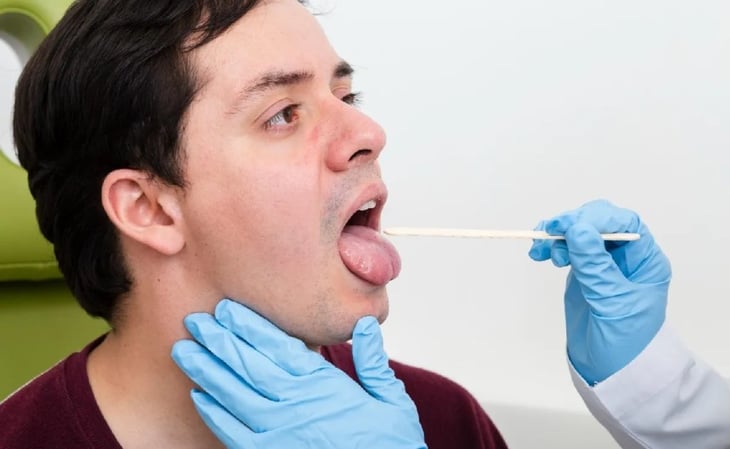 Un examen de saliva podría ser más efectivo para detectar el cáncer de próstata