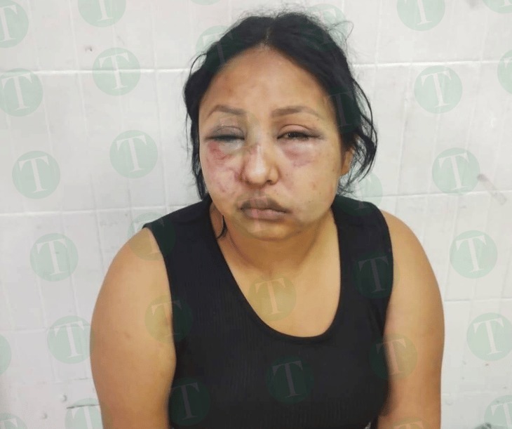 Karla tramita orden de restricción contra su esposo golpeador y familia política 