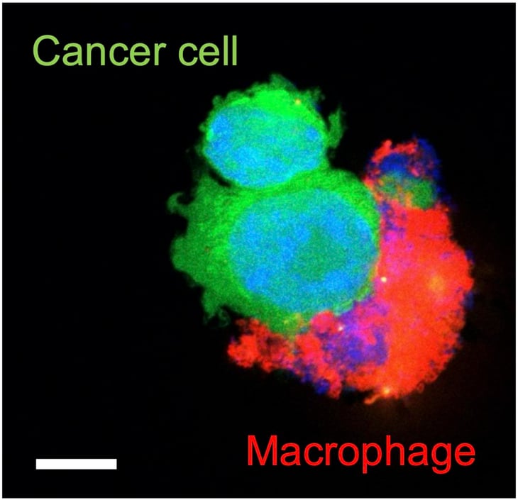 Llega la nanomedicina dual: ataca las células cancerosas y potencia el sistema inmune