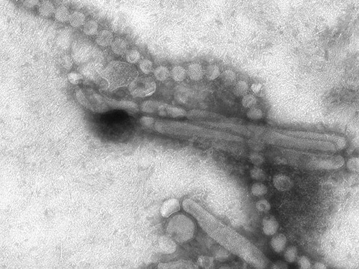Los virus antiguos podrían estar estimulando los cánceres modernos