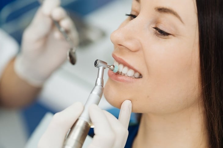 Carillas dentales: todo lo que necesitas saber