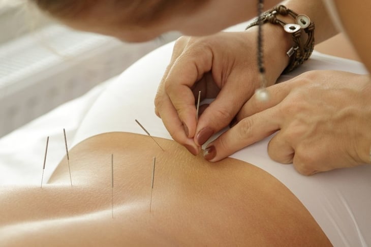 La acupuntura puede aliviar los efectos secundarios del tratamiento del cáncer de mama