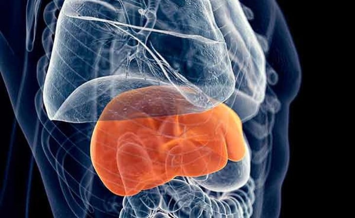 La hepatitis: una amenaza silenciosa que puede desencadenar cáncer hepático si no se controla