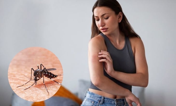 Oropouche: ¿Qué es y cuáles son los síntomas del virus detectado en América Latina?