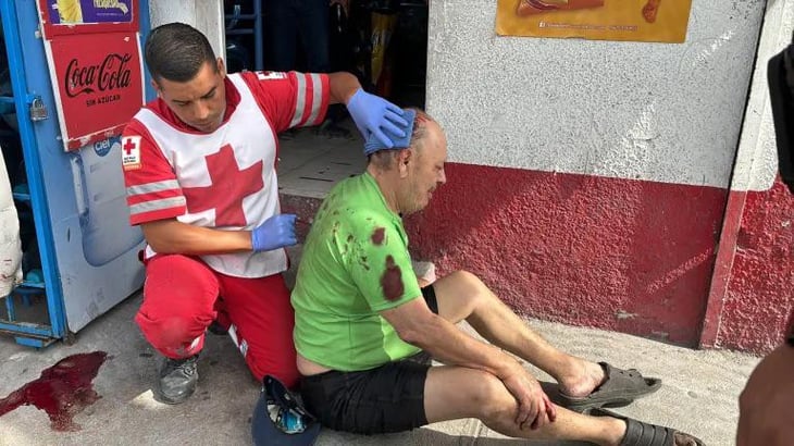 Ancianito pierde la vida tras accidente y paro cardiaco