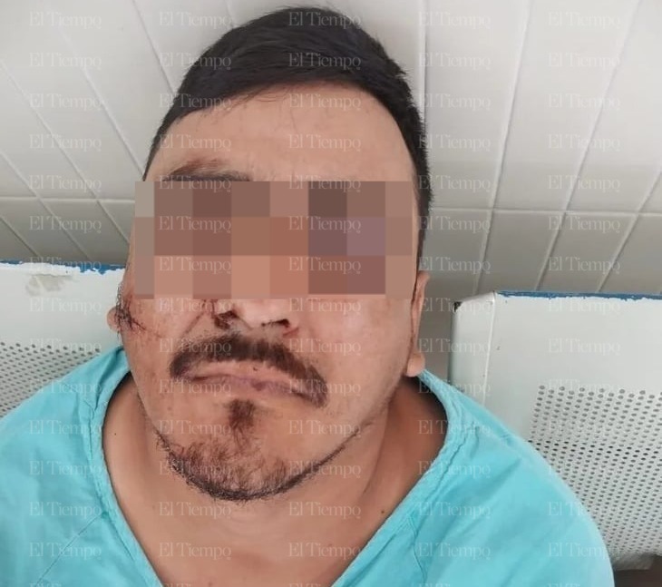 Joven fue brutalmente golpeado en festejo de aniversario de Palo Blanco 