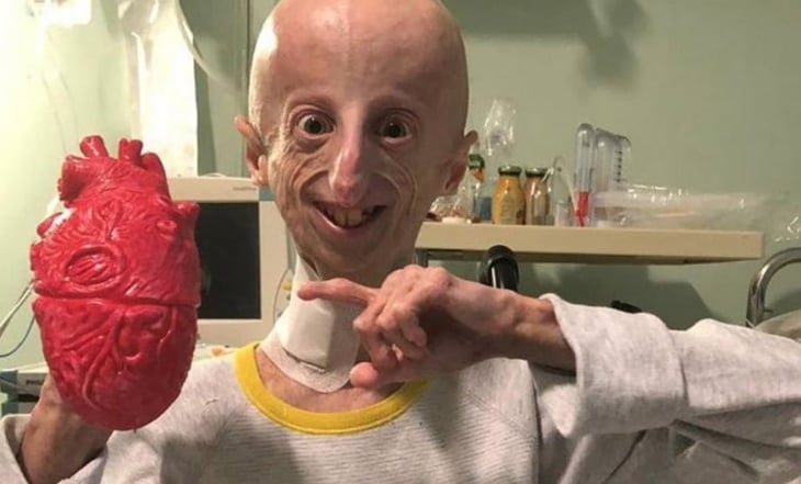 Fallece Sammy Basso, científico con progeria que investigaba su enfermedad