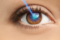 LASIK con un modelo ocular 3D proporciona una mejor corrección de la visión