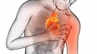 Diaforesis: El signo de un ataque al corazón que avisa con anticipación