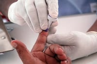 Alertan incremento de casos de VIH en Yucatán y Morelos en 2025