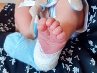 ¿Por qué el tamiz neonatal es vital para tu bebé en los primeros días de vida?