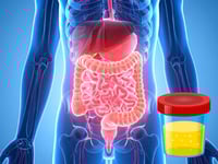 BUN: ¿Cuándo un nivel alto podría revelar un daño en la función renal o hepático?