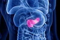 El índice de riesgo ayuda a predecir la recurrencia del cáncer de páncreas