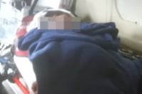 Esperanza y angustia tras injertos de piel a la bebé Margarita Rubí