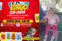 Bingo solidario para Margarita, bebé con quemaduras graves
