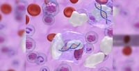 Ciencia y salud: Por qué la inyección del sarampión no se pone en el glúteo