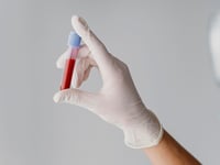 Detectan huellas de ARN que permiten identificar y monitorear el cáncer con una muestra de sangre