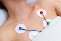 Holter cardíaco: para qué sirve el estudio que registra el ritmo del corazón durante 24 horas