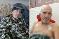 Tras atropello, abuelito enfrenta la vida sin recursos para sanar