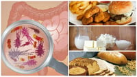 9 Alimentos que arruinan tu salud intestinal a diario