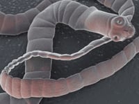 Parásito común que se oculta en muchas personas es más complejo