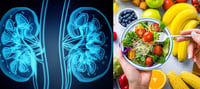 Tres alimentos que consume a diario y afectan sus riñones gravemente en silencio