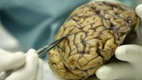 La proteína del cáncer que protege frente al alzhéimer