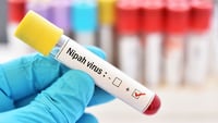 Fármaco desarrollado para Covid-19 podría servir contra Nipah