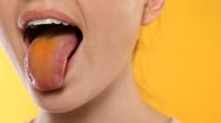 ¿Lengua amarilla al despertar? Esto es lo que tu boca intenta decirte