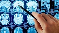 9 señales de alerta de un aneurisma cerebral que nunca debes ignorar