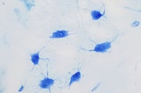 Científicos descubren que los primeros ancestros de la vida compleja 