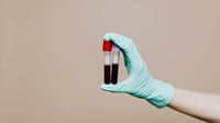 Un análisis de sangre puede predecir la supervivencia a corto plazo entre los mayores
