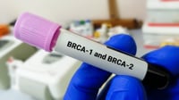 Mastectomía bilateral profiláctica en portadoras de mutaciones BRCA1/BRCA2