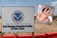 Reportan 14 casos de sarampión en centro migrante de El Paso, Texas